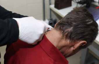 botox-pelo-sus-ajuda-pacientes