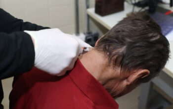 botox-pelo-sus-ajuda-pacientes